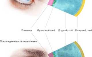 Синдром сухого глаза и остеохондроз