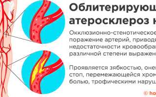 Атеросклероз сосудов н конечностей код по мкб