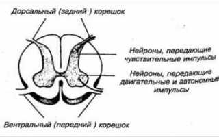 Корешковый синдром при шейном остеохондрозе
