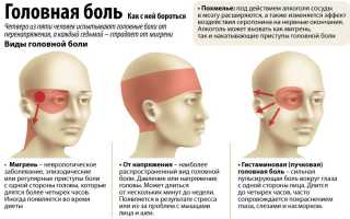 Всд с цефалгическим синдромом у детей
