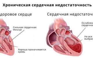 Код по мкб к50