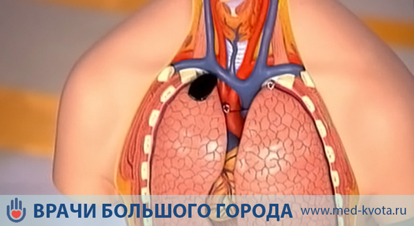 Диагностика рака Панкоста