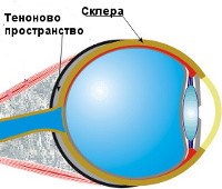 Тенонит