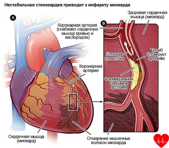 Болевой синдром в спине справа