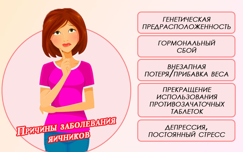 Причины заболевания яичников