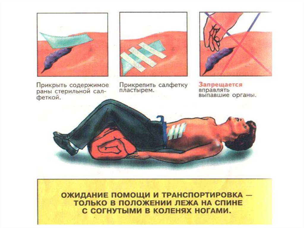 Код мкб ранение живота